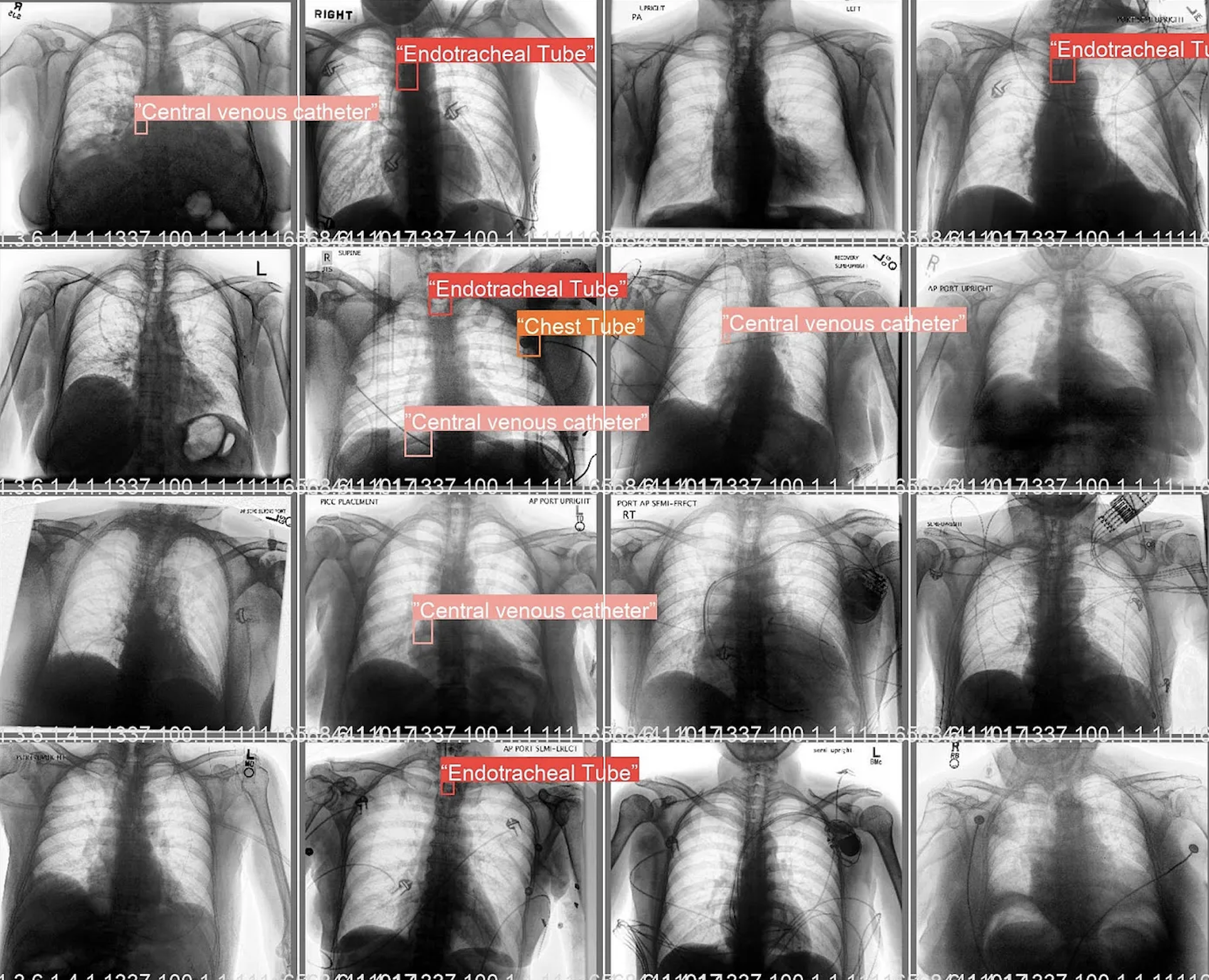 Medical Device Localization in X-Rays